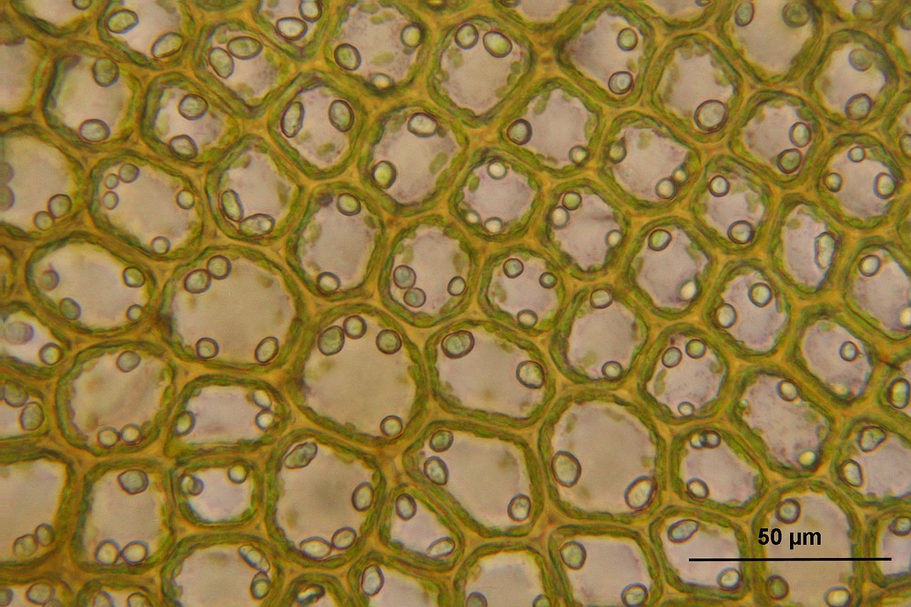 a close up of a plant cell 
Bazania truncatula, microscopic, cell picture